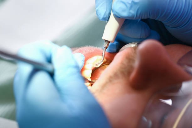 Best Walk-In Dentist Near Me  in Wamac, IL